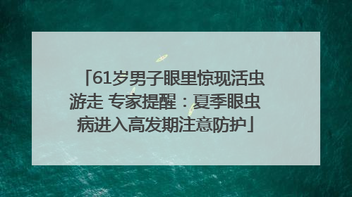 61岁男子眼里惊现活虫游走 专家提醒：夏季眼虫病进入高发期注意防护